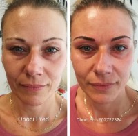 /album/fotogalerie/oboci-2022-jpg16-jpg/